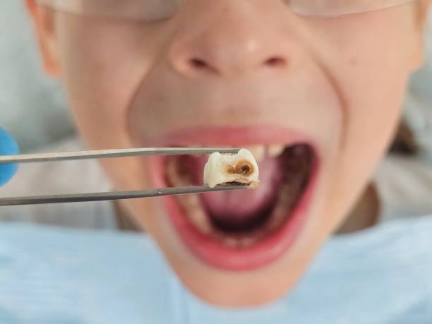Best Emergency Dental Care for Trauma or Injury in Bradford, TN